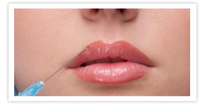 Nullam euismod commodo