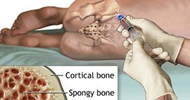 Nullam euismod commodo