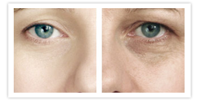 Nullam euismod commodo